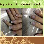 repousse 6 semaines